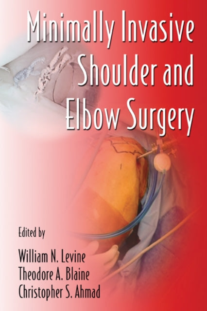 Book cover of: Minimally Invasive Shoulder and Elbow Surgery