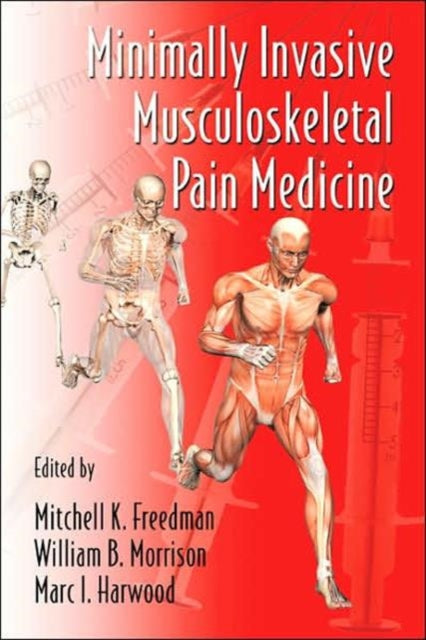 Book cover of: Minimally Invasive Musculoskeletal Pain Medicine
