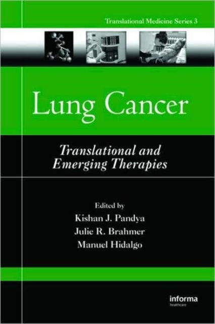Book cover of: Lung Cancer