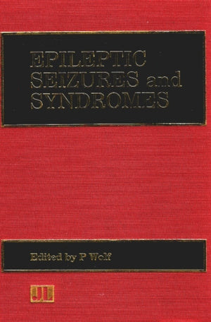 Epileptic Seizures & Syndromes