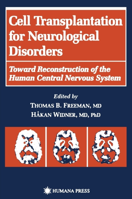 Book cover of: Cell Transplantation for Neurological Disorders