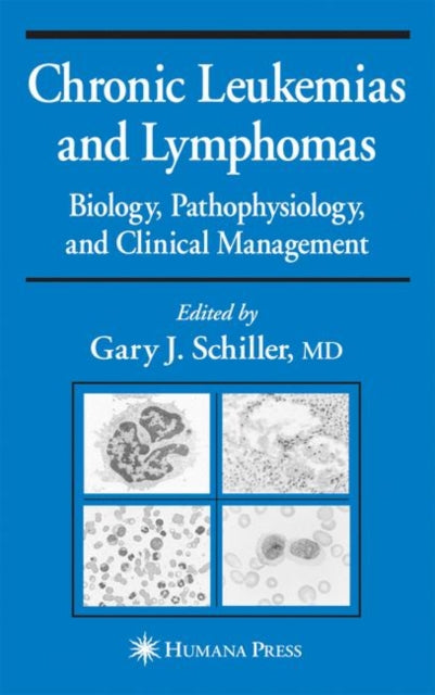 Chronic Leukemias and Lymphomas