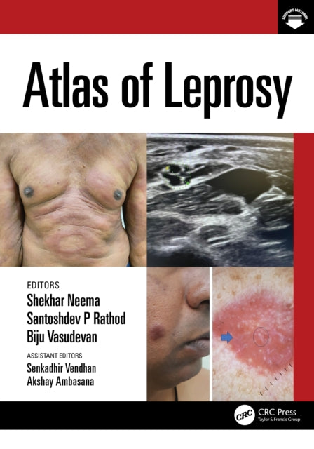 Book cover of: Atlas of Leprosy. By: Shekhar Neema