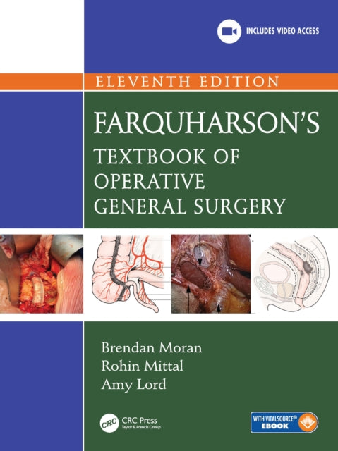 Book cover of: Farquharson's Textbook of Operative General Surgery