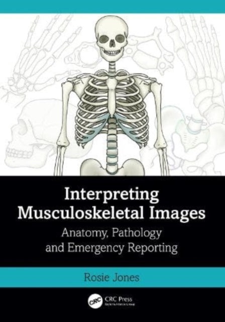 Book cover of: Interpreting Musculoskeletal Images. By: Rosie Jones