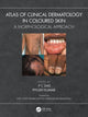 Book cover of: Atlas of Clinical Dermatology in Coloured Skin. By: P. C. Das