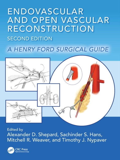 Book cover of: Endovascular and Open Vascular Reconstruction