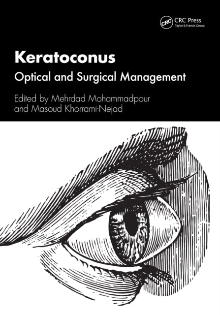 Book cover of: Keratoconus. By: Mehrdad Mohammadpour