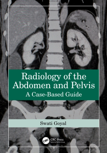 Book cover of: Radiology of the Abdomen and Pelvis