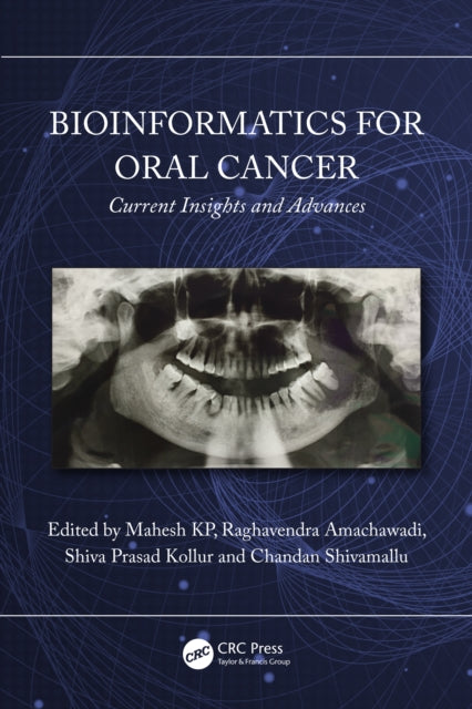 Book cover of: Bioinformatics for Oral Cancer. By: Mahesh Kp