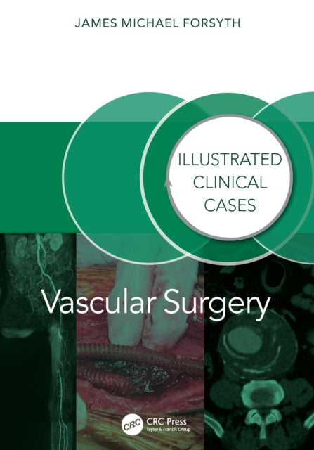Book cover of: Vascular Surgery:. By: James Forsyth