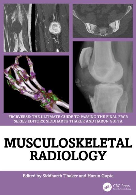 Book cover of: Musculoskeletal Radiology