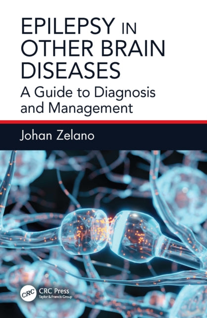 Book cover of: Epilepsy in Other Brain Diseases. By: Johan Zelano