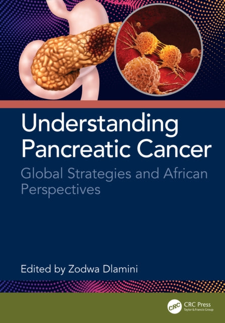 Book cover of: Understanding Pancreatic Cancer