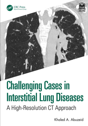 Challenging Cases in Interstitial Lung Diseases