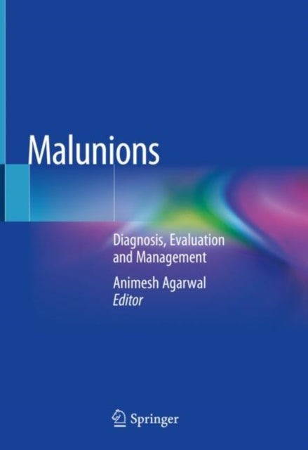 Book cover of: Malunions. By: Animesh Agarwal