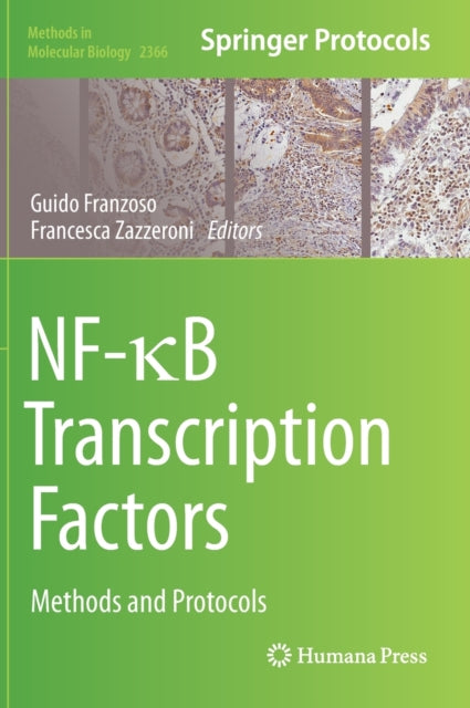 Book cover of: NF-?B Transcription Factors. By: Guido Franzoso