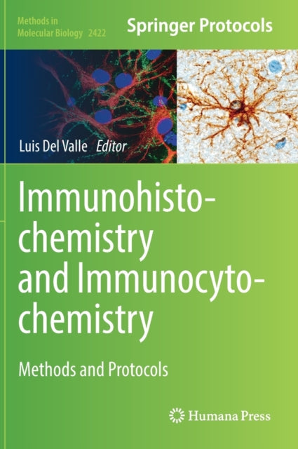 Book cover of: Immunohistochemistry and Immunocytochemistry. By: Luis Del Valle