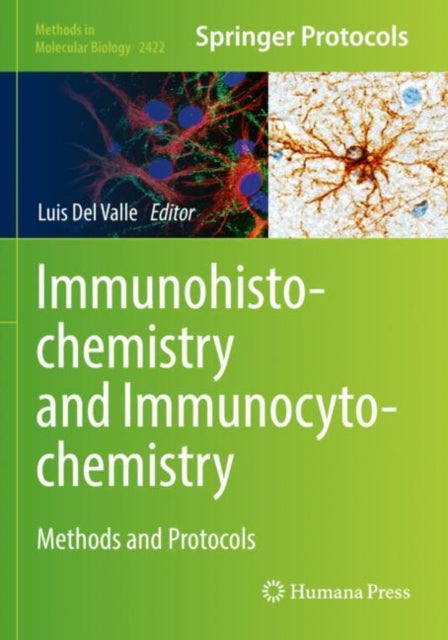 Book cover of: Immunohistochemistry and Immunocytochemistry. By: Luis Del Valle
