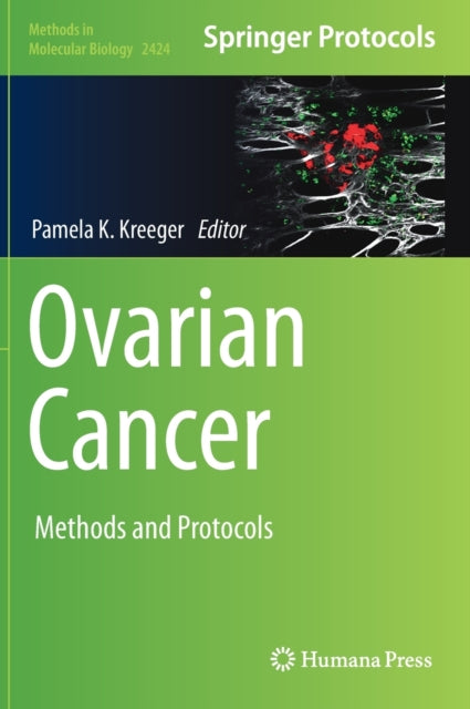 Book cover of: Ovarian Cancer. By: Pamela K. Kreeger