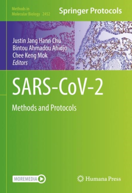 Book cover of: SARS-CoV-2. By: Justin Jang Hann Chu