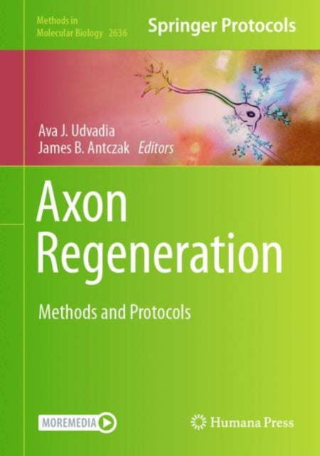 Book cover of: Axon Regeneration. By: Ava J. Udvadia