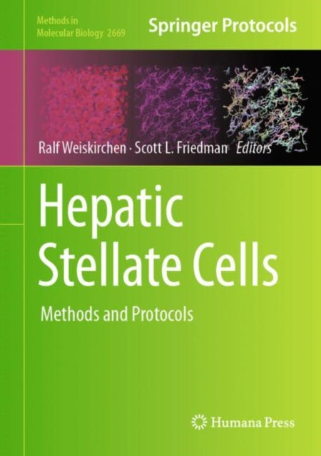 Book cover of: Hepatic Stellate Cells. By: Ralf Weiskirchen