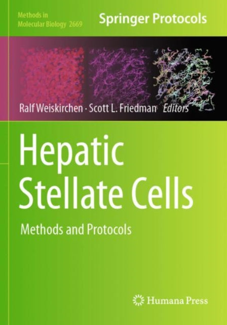 Book cover of: Hepatic Stellate Cells. By: Ralf Weiskirchen