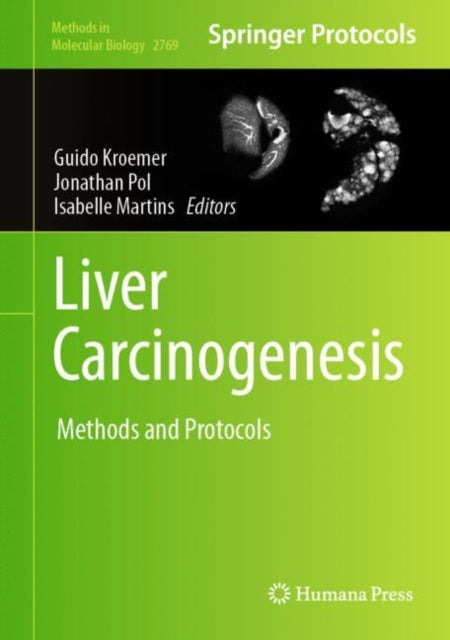 Book cover of: Liver Carcinogenesis. By: Guido Kroemer