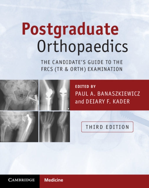 Book cover of: Postgraduate Orthopaedics. By: Paul A. Banaszkiewicz