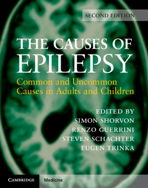 Book cover of: Causes of Epilepsy. By: Simon Shorvon