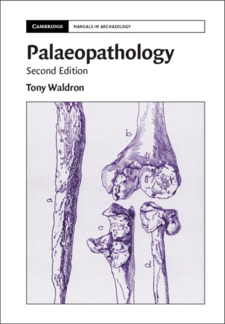 Book cover of: Palaeopathology. By: Tony Waldron