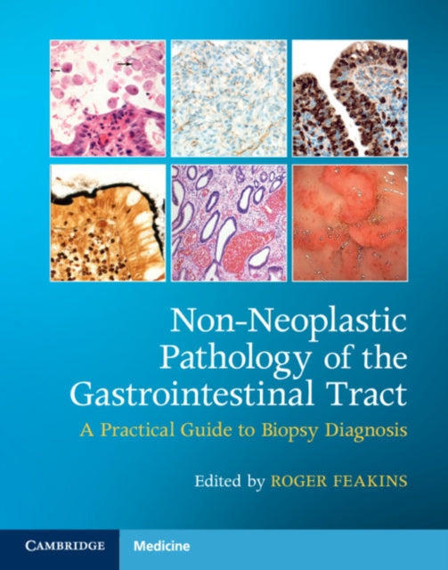 Book cover of: Non-Neoplastic Pathology of the Gastrointestinal Tract with Online Resource. By: Roger Feakins