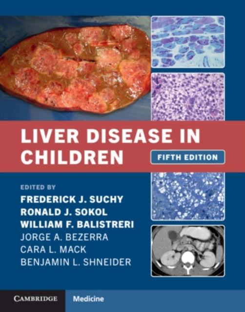 Book cover of: Liver Disease in Children. By: Frederick J. Suchy