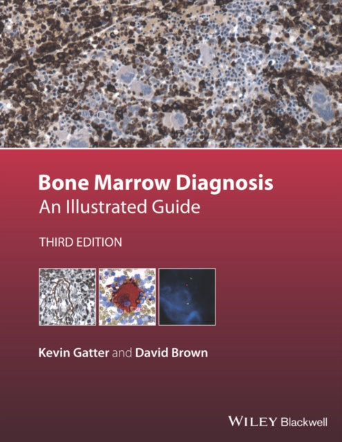 Book cover of: Bone Marrow Diagnosis. By: Kevin Gatter