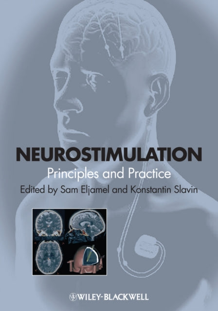 Book cover of: Neurostimulation. By: Sam Eljamel