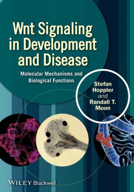 Book cover of: Wnt Signaling in Development and Disease. By: Stefan P. Hoppler