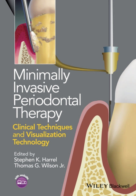 Book cover of: Minimally Invasive Periodontal Therapy. By: Stephen K. Harrel