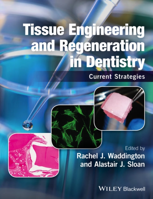 Book cover of: Tissue Engineering and Regeneration in Dentistry. By: Rachel J. Waddington