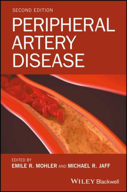 Book cover of: Peripheral Artery Disease. By: Emile R. Mohler