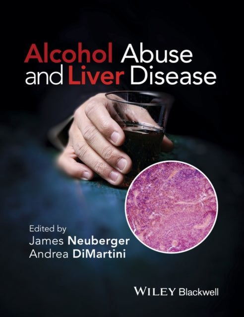 Book cover of: Alcohol Abuse and Liver Disease. By: James Neuberger
