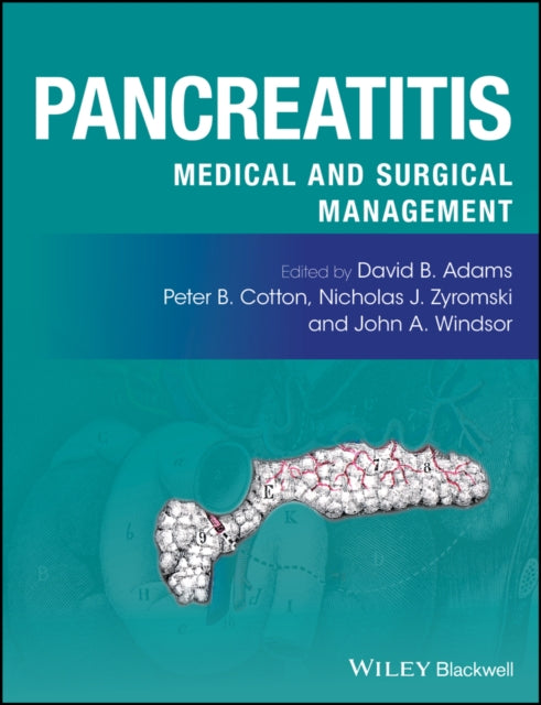 Book cover of: Pancreatitis