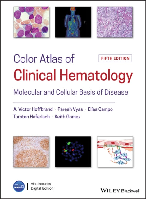 Book cover of: Color Atlas of Clinical Hematology. By: A. Victor Hoffbrand