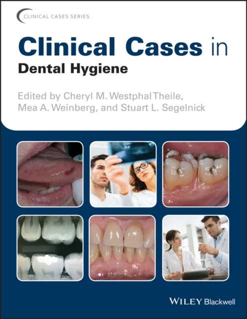 Book cover of: Clinical Cases in Dental Hygiene. By: Stuart L. Segelnick