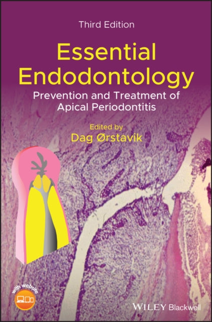 Book cover of: Essential Endodontology. By: Dag Orstavik