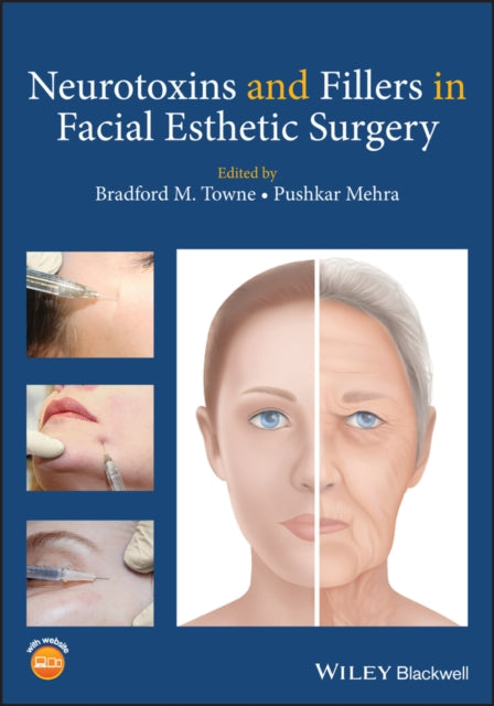 Book cover of: Neurotoxins and Fillers in Facial Esthetic Surgery