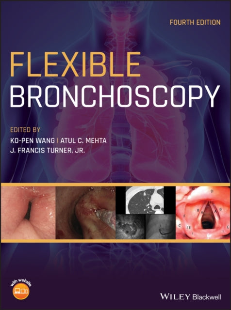 Book cover of: Flexible Bronchoscopy. By: Atul C. Mehta