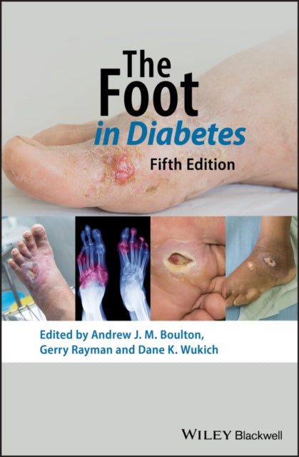 Book cover of: Foot in Diabetes. By: Andrew J. M. Boulton