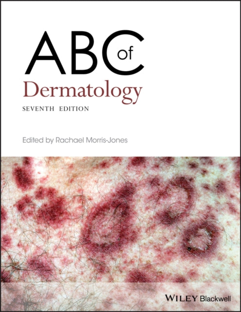 Dermatoloogia ABC