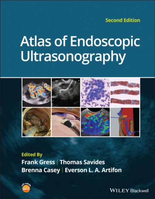 Book cover of: Atlas of Endoscopic Ultrasonography. By: Frank G. Gress